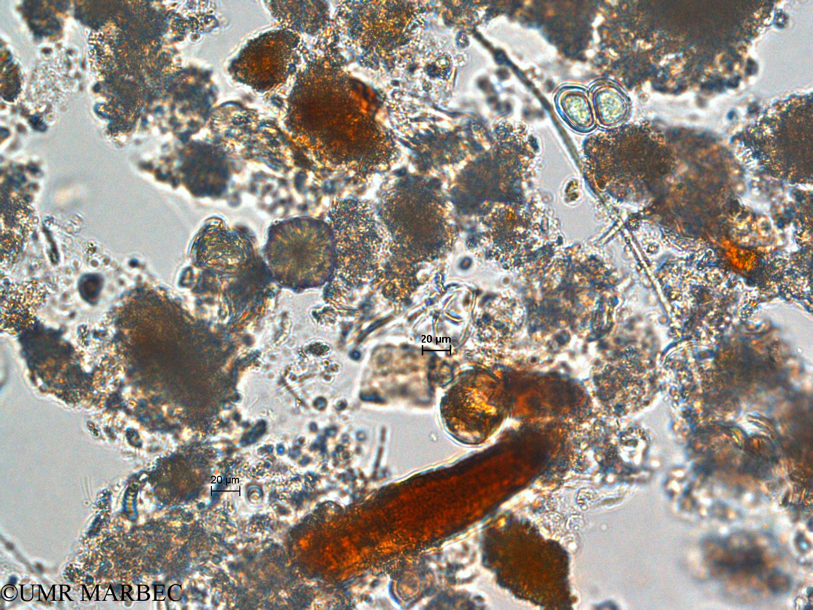 phyto/Scattered_Islands/europa/COMMA April 2011/Chroococcus turgidus (ancien C. sp8 -1)(copy).jpg